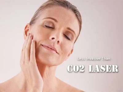 14 14